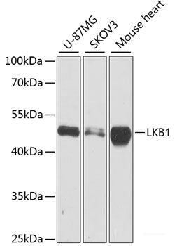 Western blot analysis of extracts of various cell lines using TriMethyl-Histone H3-K79 Polyclonal Antibody.