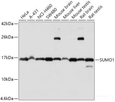 Western blot analysis of extracts of various cell lines using TriMethyl-Histone H4-K20 Polyclonal Antibody at dilution of 1:1000.