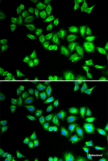 Western blot analysis of extracts of various cell lines using Pan Acetyl-Lysine Polyclonal Antibody at dilution of 1:1000. HeLa cells and NIH/3T3 cells and C6 cells were treated by TSA (1 uM) at 37°C for 18 hours.