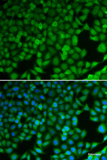 Western blot analysis of extracts of various cell lines using SQLE Polyclonal Antibody at dilution of 1:1000.