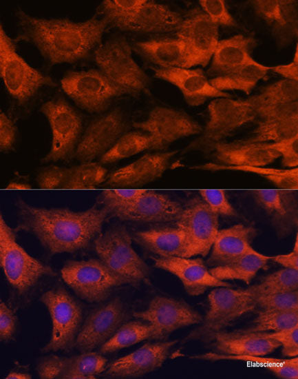 Immunohistochemistry of paraffin-embedded Human esophagus using CDK1 Polyclonal Antibody at dilution of 1:100 (40x lens).