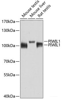 Immunohistochemistry of paraffin-embedded Rat heart using FLNB Polyclonal Antibody at dilution of 1:100 (40x lens).