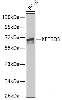 Immunohistochemistry of paraffin-embedded Rat liver using GTF2F1 Polyclonal Antibody at dilution of 1:200 (40x lens).