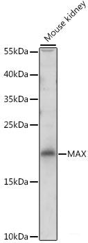 Western blot analysis of extracts of various cell lines using NUP62 Polyclonal Antibody at dilution of 1:1000.