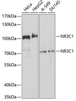 Western blot analysis of extracts of various cell lines using PSMA2 Polyclonal Antibody at dilution of 1:1000.