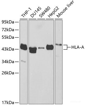 Immunohistochemistry of paraffin-embedded Rat brain using EEF1D Polyclonal Antibody at dilution of 1:200 (40x lens).