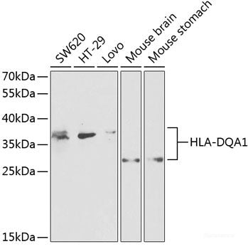 Western blot analysis of extracts of various cell lines using GNAO1 Polyclonal Antibody at dilution of 1:1000.