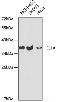 Western blot analysis of extracts of various cell lines using PSMA4 Polyclonal Antibody at dilution of 1:1000.