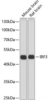 Immunohistochemistry of paraffin-embedded Mouse lung using ATP2C1 Polyclonal Antibody at dilution of 1:100 (40x lens).