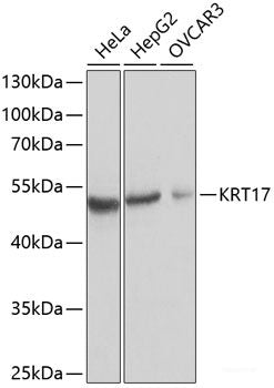 Western blot analysis of extracts of various cell lines using HNMT Polyclonal Antibody at dilution of 1:1000.