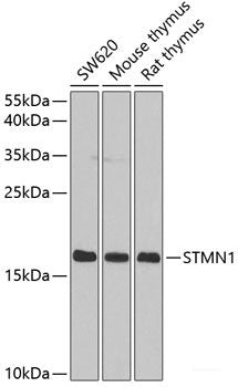Immunohistochemistry of paraffin-embedded Rat kidney using NEDD9 Polyclonal Antibody at dilution of 1:200 (40x lens).