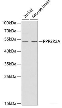 Western blot analysis of extracts of Mouse brain using DKK3 Polyclonal Antibody at dilution of 1:1000.