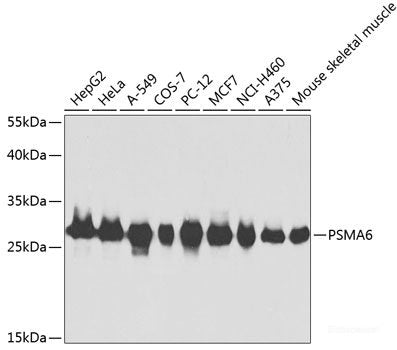 Western blot analysis of extracts of Mouse liver using OAS1 Polyclonal Antibody at dilution of 1:1000.