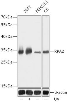 Western blot analysis of extracts of various cell lines using PCBP2 Polyclonal Antibody at dilution of 1:1000.