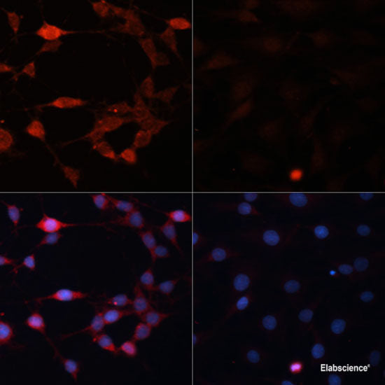 Western blot analysis of extracts of various cell lines using RPS3 Polyclonal Antibody at dilution of 1:1000.
