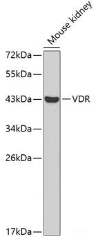 Western blot analysis of extracts of various cell lines using TNXB Polyclonal Antibody at dilution of 1:1000.