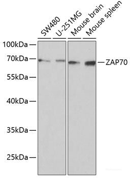 Western blot analysis of extracts of OVCAR3 cells using TRAF5 Polyclonal Antibody at dilution of 1:1000.