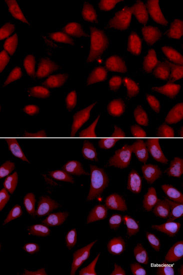 Immunofluorescence analysis of HeLa cells using DNASE1 Polyclonal Antibody
