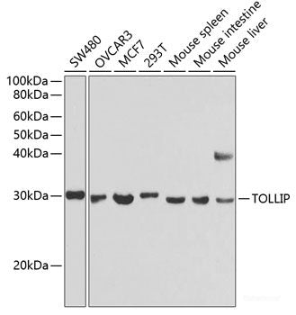 Western blot analysis of extracts of Mouse kidney using ADIPOQ Polyclonal Antibody at dilution of 1:1000.