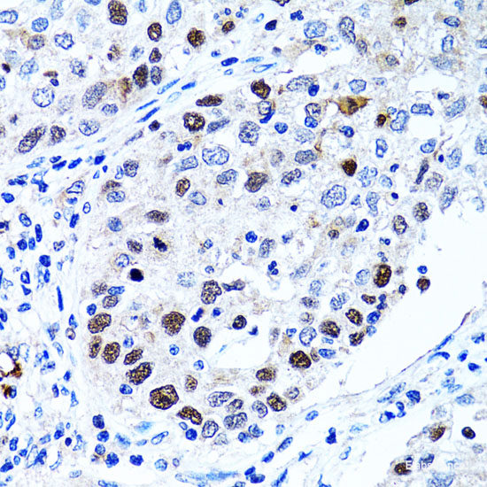 Immunohistochemistry of paraffin-embedded Rat spleen using CD19 Polyclonal Antibody at dilution of 1:100 (40x lens).