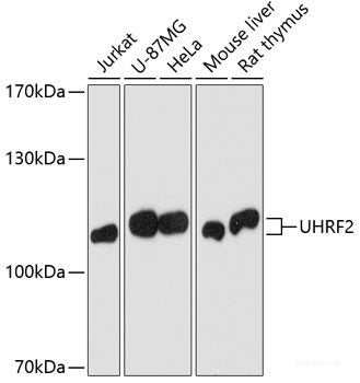 Western blot analysis of extracts of various cell lines using FES Polyclonal Antibody at dilution of 1:1000.