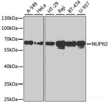 Immunohistochemistry of paraffin-embedded Human stomach using NME3 Polyclonal Antibody at dilution of 1:100 (40x lens).