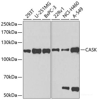 Western blot analysis of extracts of various cell lines using DNAJC7 Polyclonal Antibody at dilution of 1:1000.