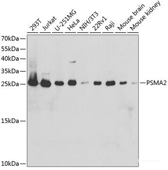 Immunohistochemistry of paraffin-embedded Rat spleen using PSMD3 Polyclonal Antibody at dilution of 1:200 (40x lens).