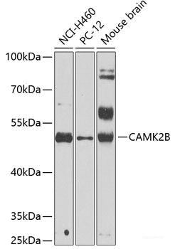 Western blot analysis of extracts of various cell lines using USO1 Polyclonal Antibody at dilution of 1:500.