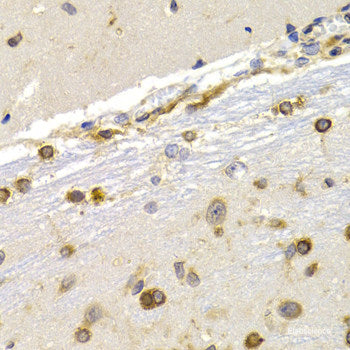 Immunohistochemistry of paraffin-embedded Rat liver using SERPINA3 Polyclonal Antibody at dilution of 1:100 (40x lens).
