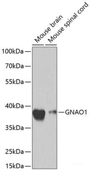 Immunohistochemistry of paraffin-embedded Mouse brain using ACHE Polyclonal Antibody at dilution of 1:100 (40x lens).