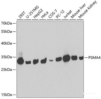 Immunohistochemistry of paraffin-embedded Human stomach using GPT Polyclonal Antibody at dilution of 1:100 (40x lens).