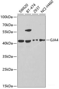 Immunohistochemistry of paraffin-embedded Mouse heart using CUL2 Polyclonal Antibody at dilution of 1:200 (40x lens).