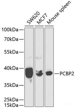 Immunohistochemistry of paraffin-embedded Rat lung using Aquaporin 4 Polyclonal Antibody at dilution of 1:100 (40x lens).