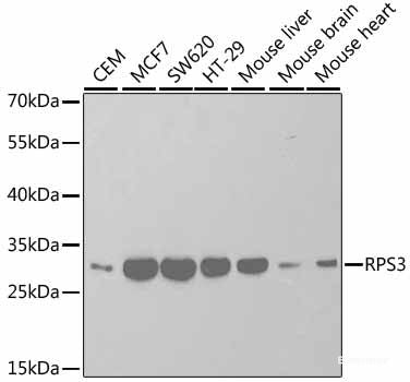 Western blot analysis of extracts of HT-29 cells using CXCR2 Polyclonal Antibody.