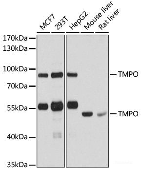 Immunohistochemistry of paraffin-embedded Human prostate using Cyclin A2 Polyclonal Antibody at dilution of 1:100 (40x lens).
