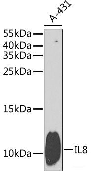 Immunohistochemistry of paraffin-embedded Rat testis using DDB1 Polyclonal Antibody at dilution of 1:100 (40x lens).
