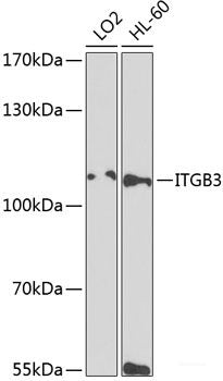 Immunohistochemistry of paraffin-embedded Human stomach using EIF4G2 Polyclonal Antibody