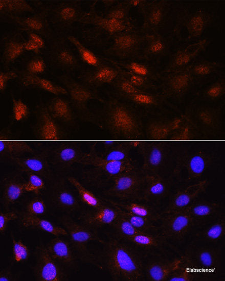 Immunohistochemistry of paraffin-embedded Human stomach using SFRP1 Polyclonal Antibody at dilution of 1:50 (20x lens).
