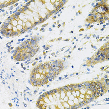Immunohistochemistry of paraffin-embedded Human prostate using EPOR Polyclonal Antibody at dilution of 1:100 (40x lens).