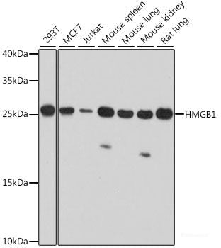 Immunofluorescence analysis of A549 cells using FOXN2 Polyclonal Antibody