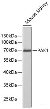 Western blot analysis of extracts of various cell lines using GABRR1 Polyclonal Antibody at dilution of 1:1000.