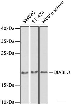 Immunohistochemistry of paraffin-embedded Rat retina using GRK1 Polyclonal Antibody at dilution of 1:200 (40x lens).