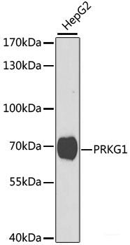 Western blot analysis of extracts of SW480 cells using KISS1R Polyclonal Antibody at dilution of 1:350.