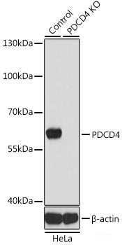 Western blot analysis of extracts of COLO320 cells using HMGA2 Polyclonal Antibody.