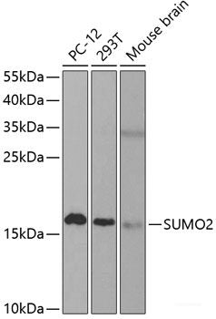 Western blot analysis of extracts of RAW264. 7 cells using HMGB2 Polyclonal Antibody.