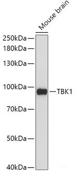 Immunofluorescence analysis of HeLa cells using HOXA11 Polyclonal Antibody at dilution of 1:100 (40x lens). Blue: DAPI for nuclear staining.