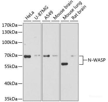 Immunohistochemistry of paraffin-embedded Human placenta using KLF5 Polyclonal Antibody at dilution of 1:100 (40x lens).