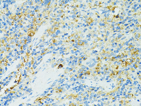Immunohistochemistry of paraffin-embedded Rat kidney using KLK5 Polyclonal Antibody at dilution of 1:200 (40x lens).