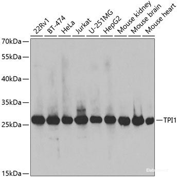 Western blot analysis of extracts of various cell lines using LEPR Polyclonal Antibody at dilution of 1:500.